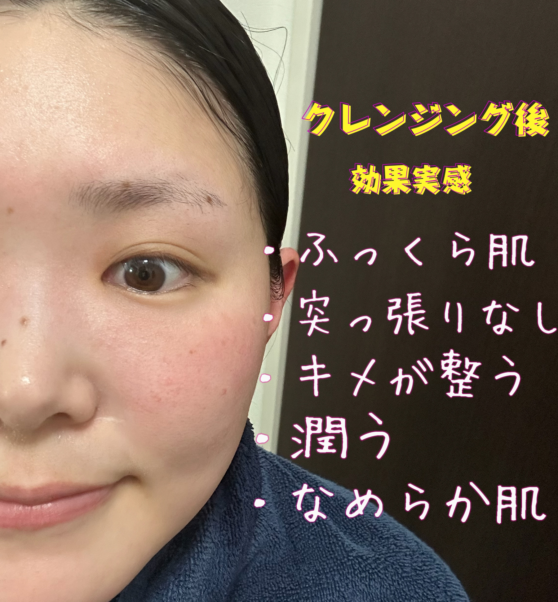 ハーブピーリングクレンジング/ESTH/クレンジングジェルを使ったクチコミ（2枚目）