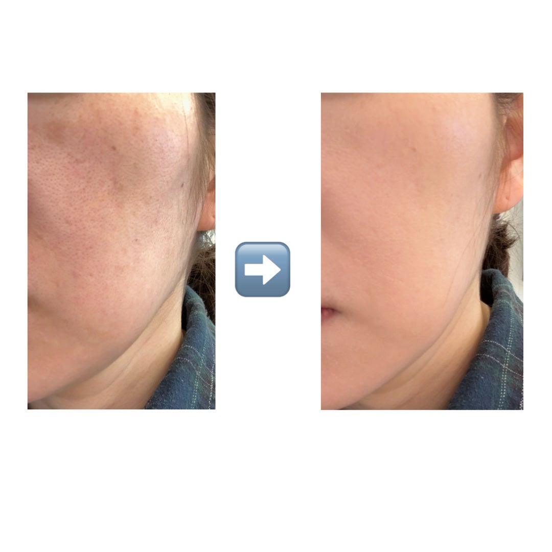 ネーミング ゼログラビティ カバーフィットクッション/NAMING./クッションファンデーションを使ったクチコミ(5枚目)