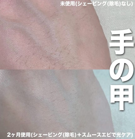 光エステ スムースエピ ES-WG0A/Panasonic/家庭用脱毛器を使ったクチコミ(6枚目)