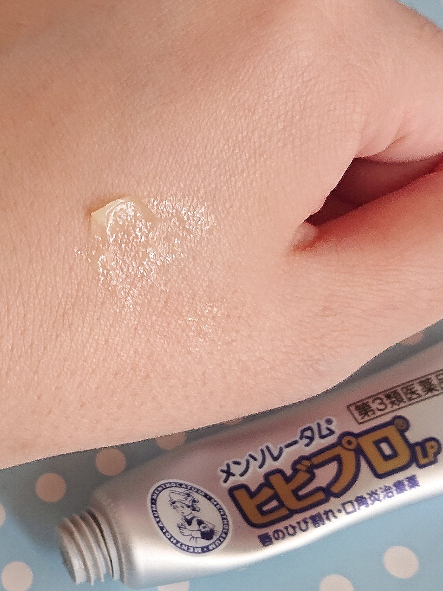 ヒビプロLP(医薬品)/メンソレータム/その他を使ったクチコミ（2枚目）