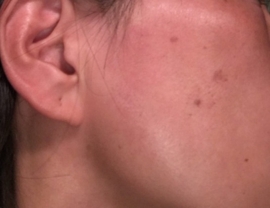 QuSomeホワイト2.0/b.glen/美容液を使ったクチコミ（2枚目）