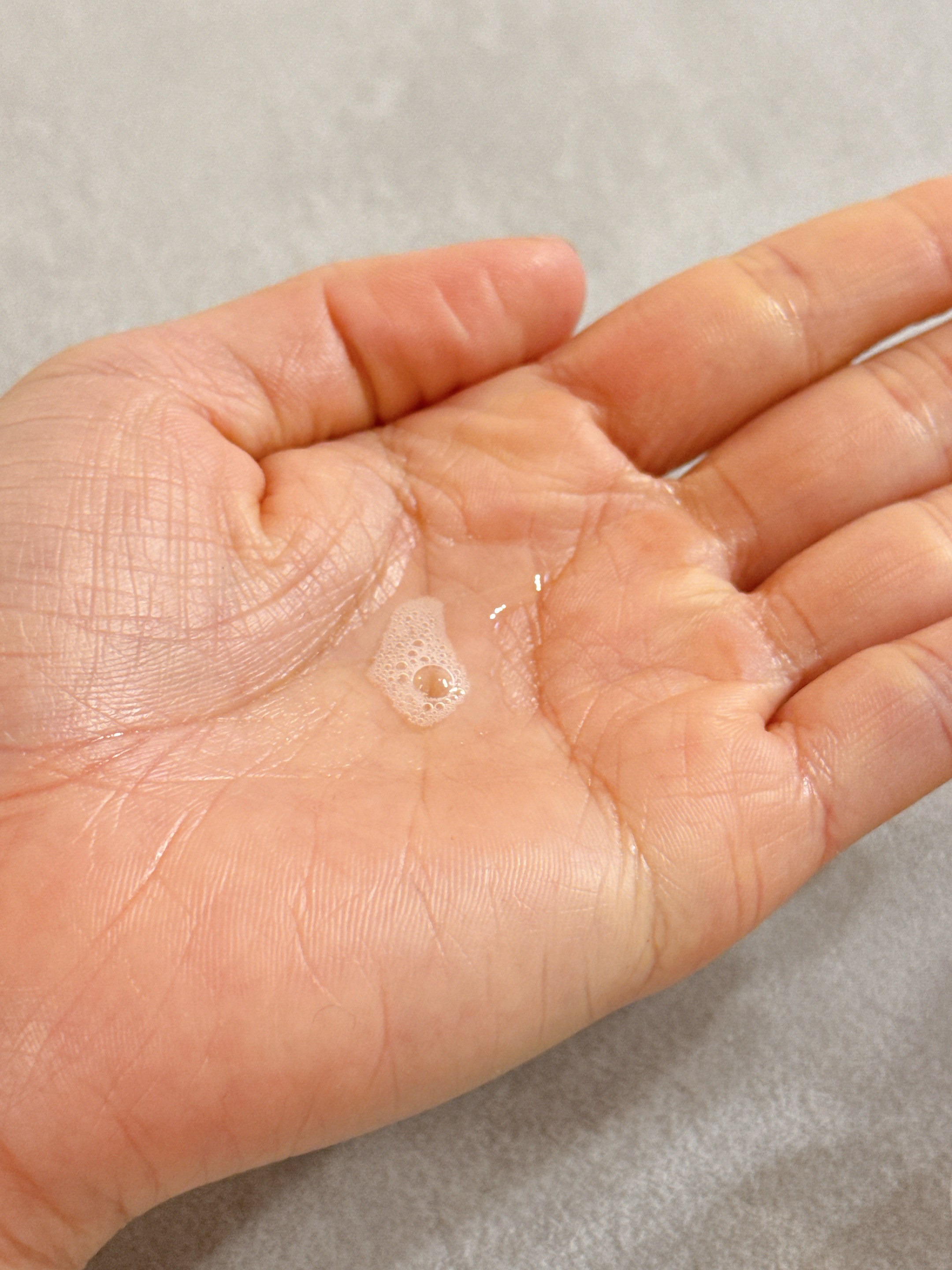 ミノン アミノモイスト 薬用アクネケア ローション/ミノン/化粧水を使ったクチコミ（2枚目）