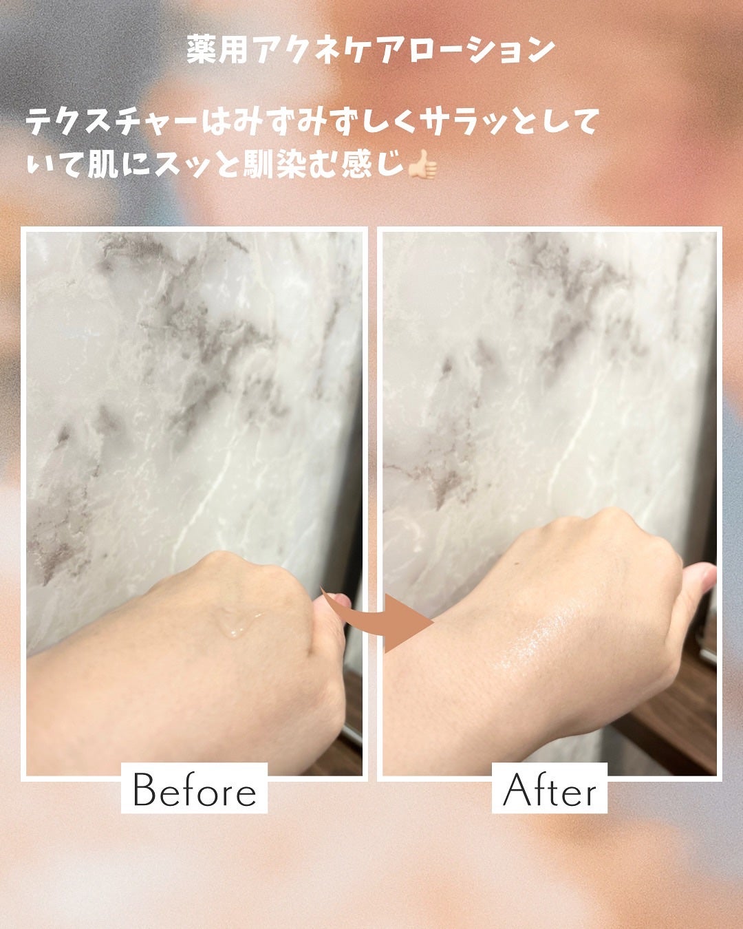 ミノン アミノモイスト 薬用アクネケア ローション/ミノン/化粧水を使ったクチコミ(3枚目)