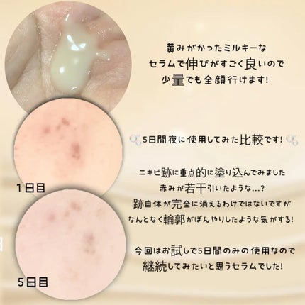 メラトーニングアンプル/Easydew/美容液を使ったクチコミ(3枚目)