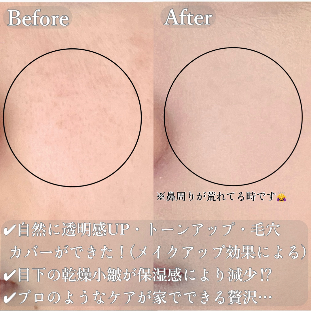 BBスキンコントロールカラー/HERBAL PEEL/化粧下地を使ったクチコミ（3枚目）