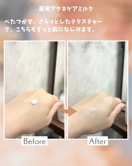 ミノン アミノモイスト 薬用アクネケア ローション/ミノン/化粧水を使ったクチコミ(4枚目)