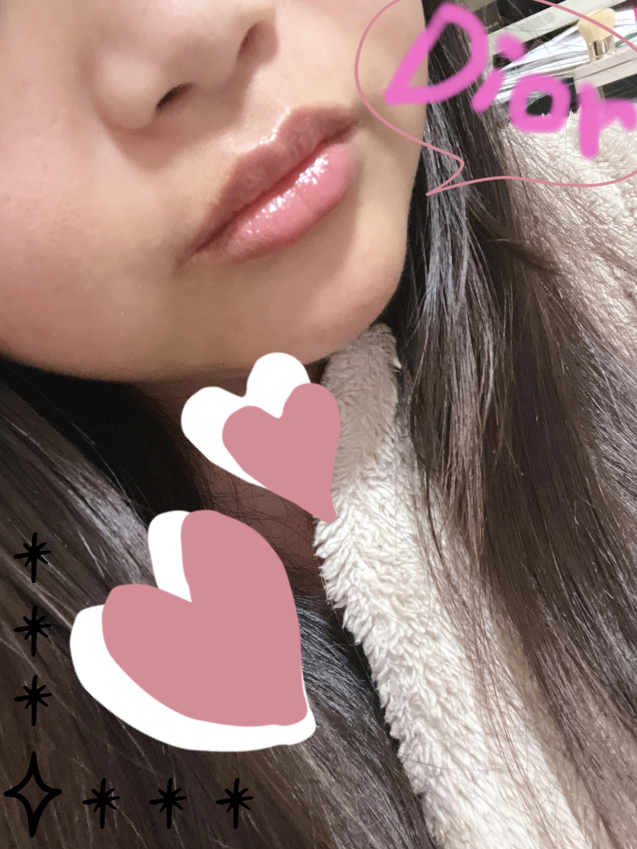 ディオール アディクト リップ グロウ 077 キャンディ/Dior/リップバームを使ったクチコミ（3枚目）