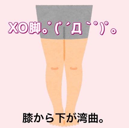 寝ながらメディキュット ロング/メディキュット/着圧ソックス・レギンスを使ったクチコミ(5枚目)