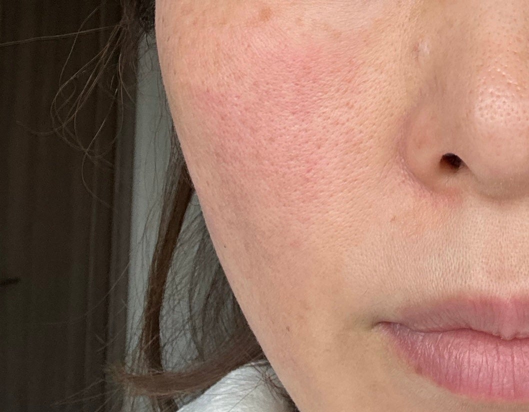 しぽ on LIPS 「Glow.mのブースターソニックエステ機器と同じ周波数で自宅で..」(2枚目)