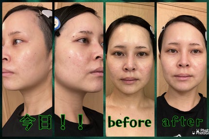 ðððŒð°ðàŸàœ²ð on LIPS ãâ¡.·â¯â¯â¯â¯â¯â¯â¯â¯â¯â¯â¯â¯â¡.·ãã¯ããã°ãã¡ãðàŸàœ²ðå..ãïŒ6æç®ïŒ