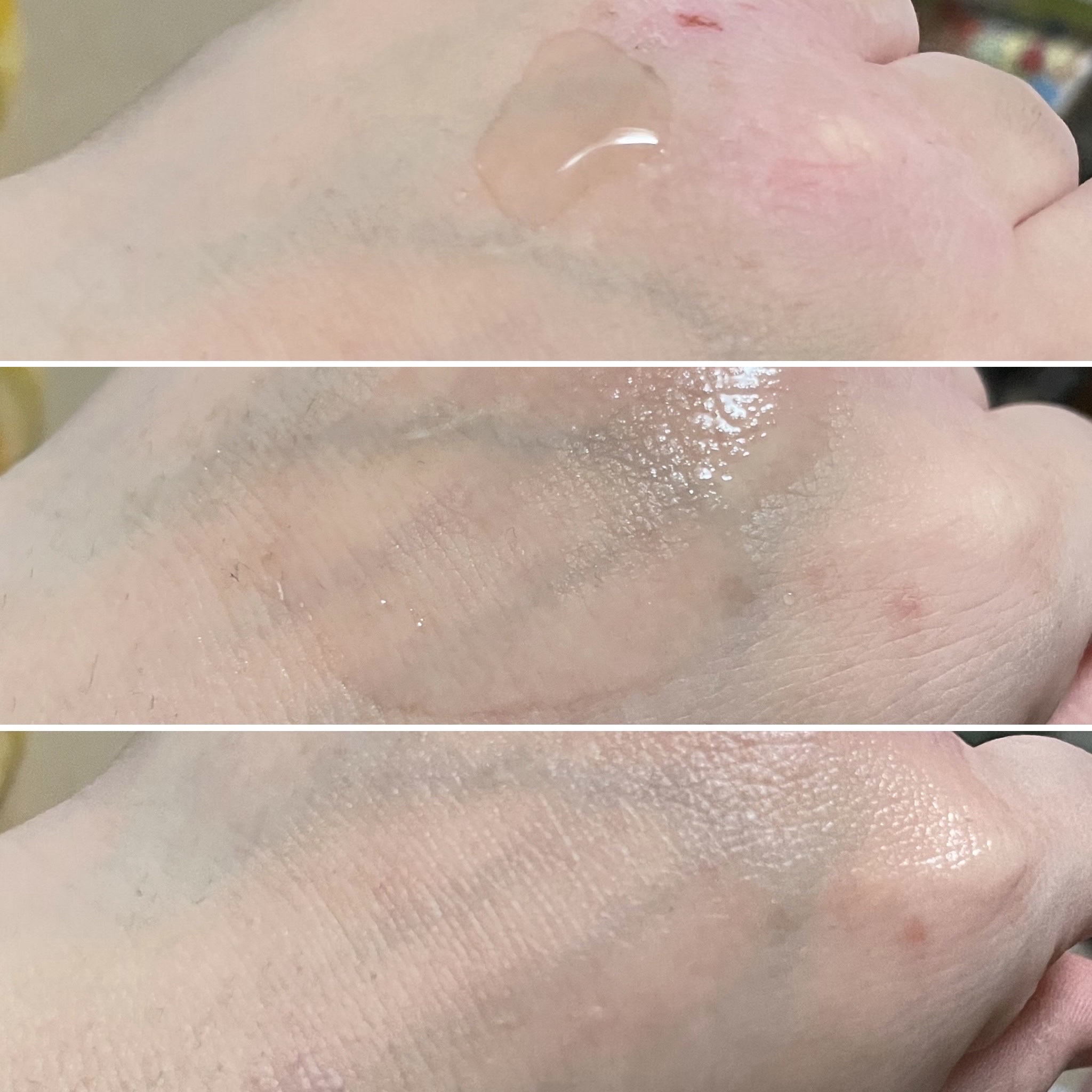 肌美精 CHOI薬用化粧水 ニキビケア[医薬部外品]/肌美精/化粧水を使ったクチコミ（2枚目）