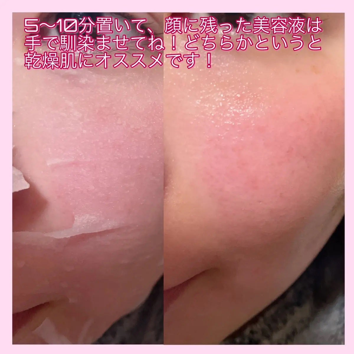 肌美精 カラーエッセンスマスク ピンク/肌美精/シートマスク・パックを使ったクチコミ(4枚目)