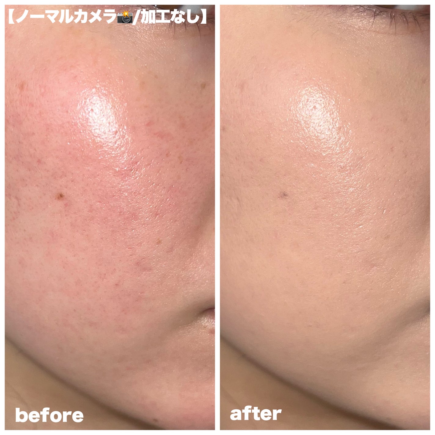 バニラコ エッセンス スキン ピンククッション/BANILA CO/クッションファンデーションを使ったクチコミ(3枚目)