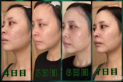 を使ったクチコミ(3枚目)