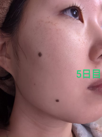 を使ったクチコミ(3枚目)