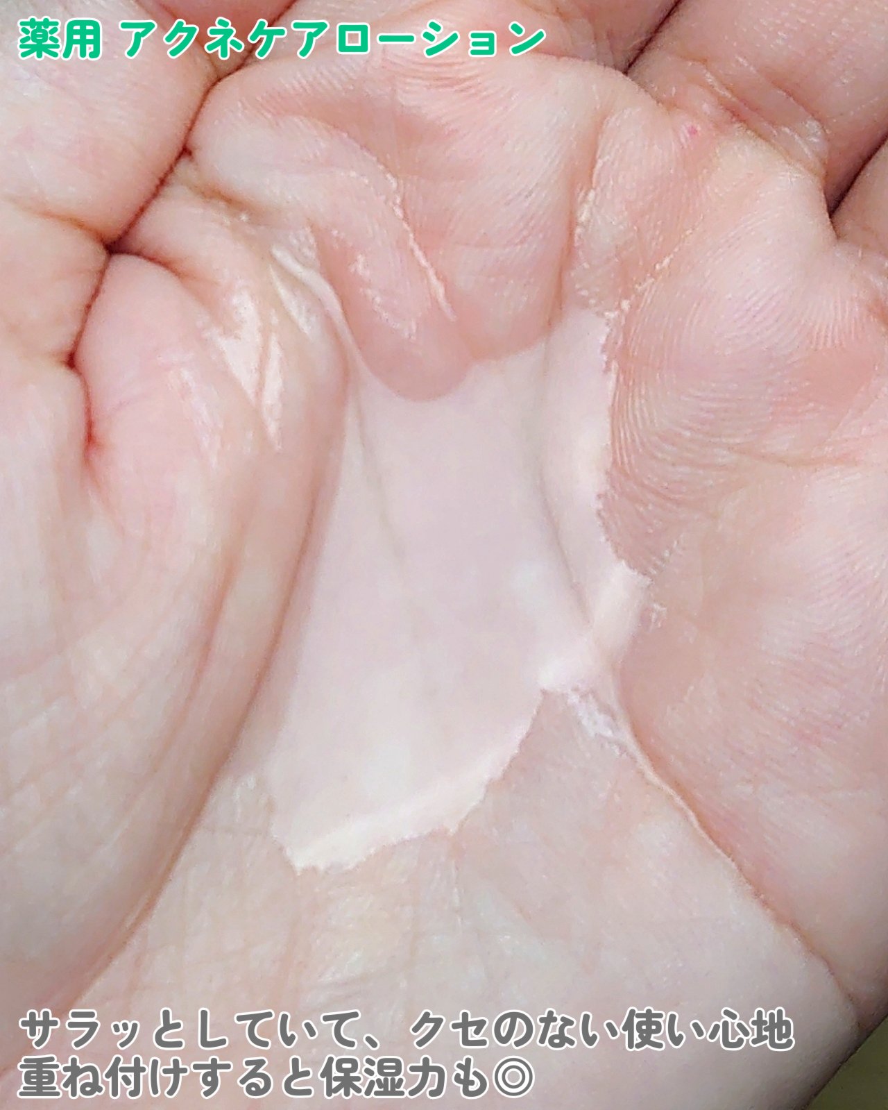 ミノン アミノモイスト 薬用アクネケア ミルク/ミノン/乳液を使ったクチコミ（3枚目）