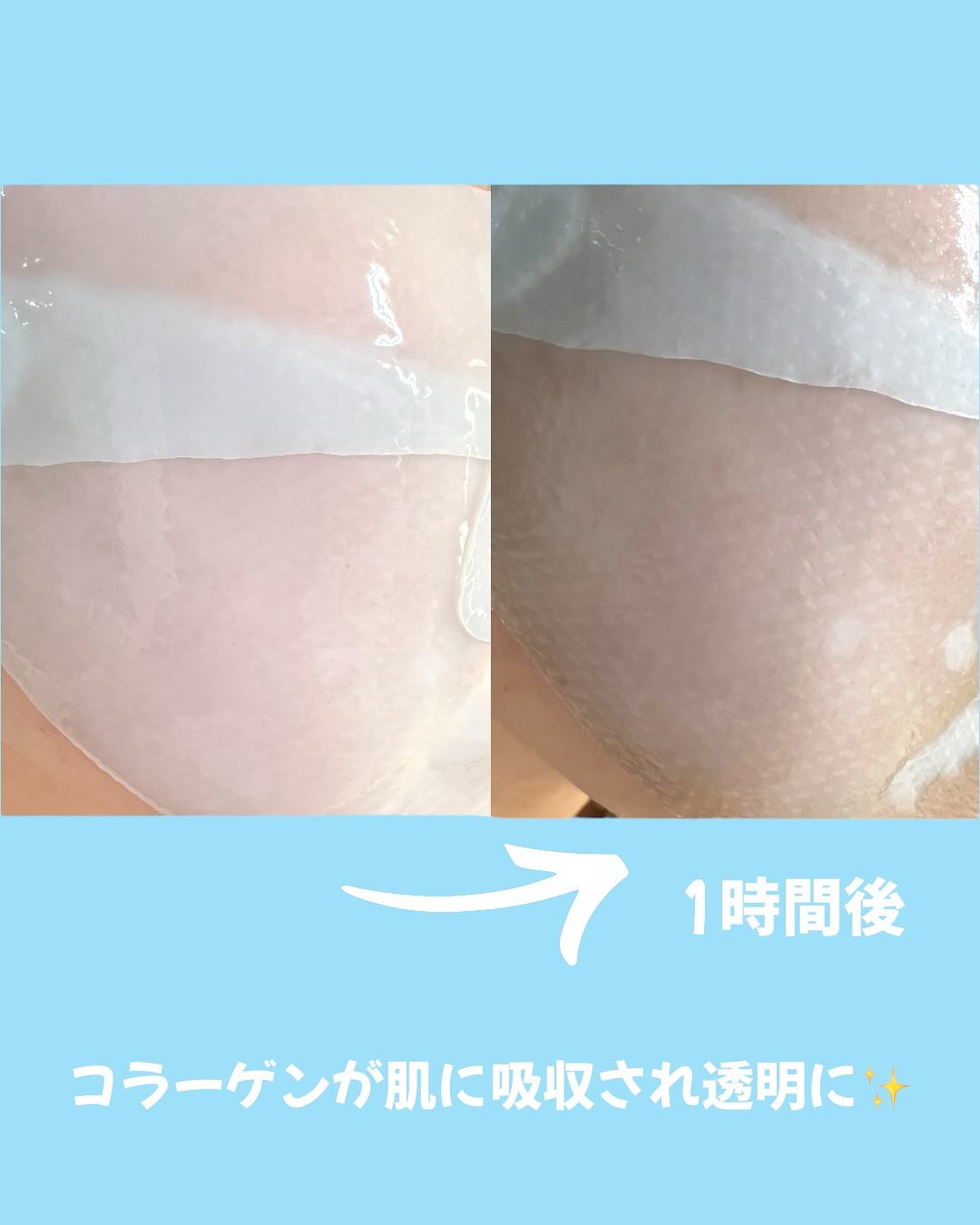 パーフェクト リアル パフォーマンス ヒアルコラーゲ ンマスクパック /ダーマフィックス/シートマスク・パックを使ったクチコミ（3枚目）