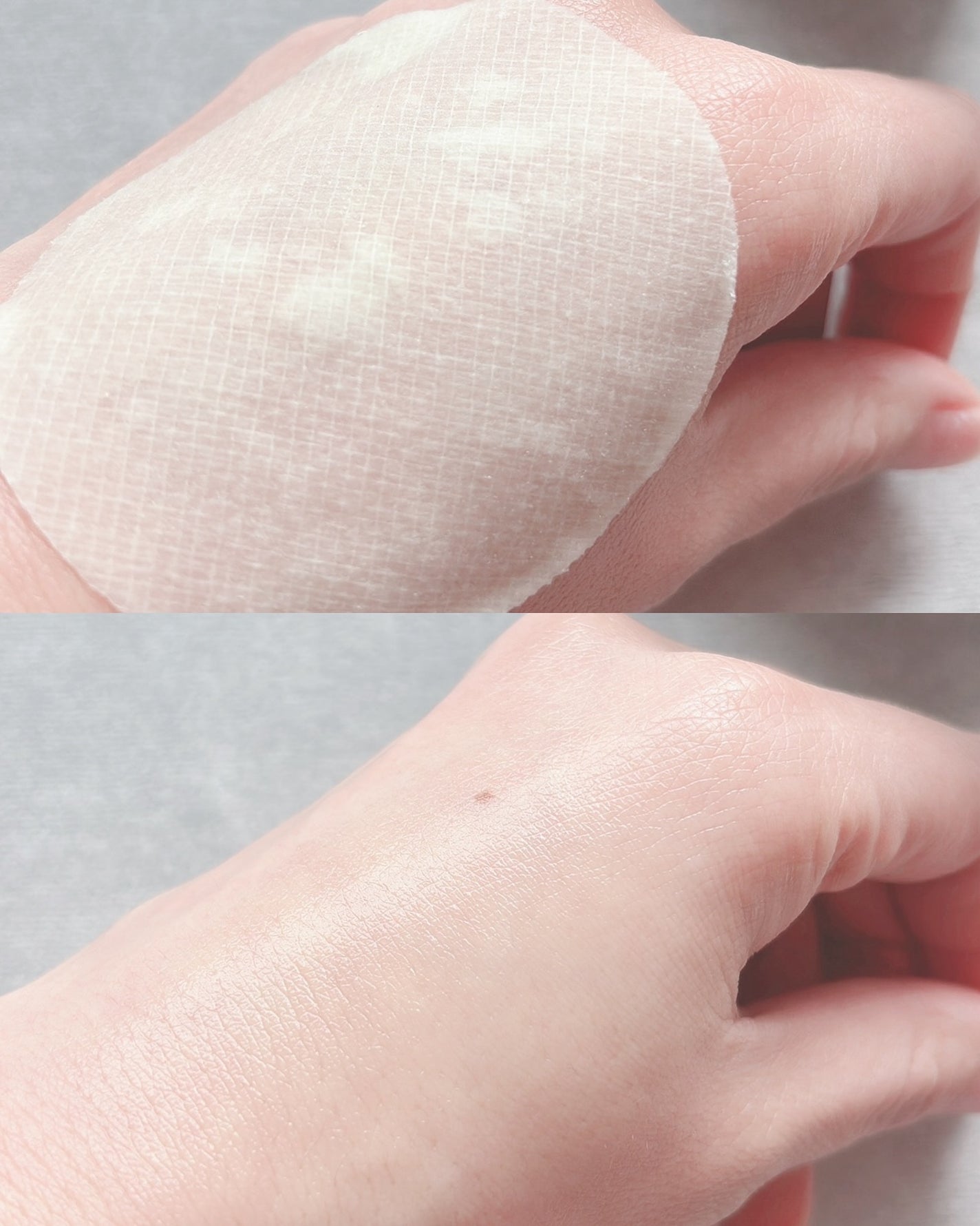 ポストアルファシカクーリングパッド/Cell Fusion C(セルフュージョンシー)/トナーパッドを使ったクチコミ(6枚目)