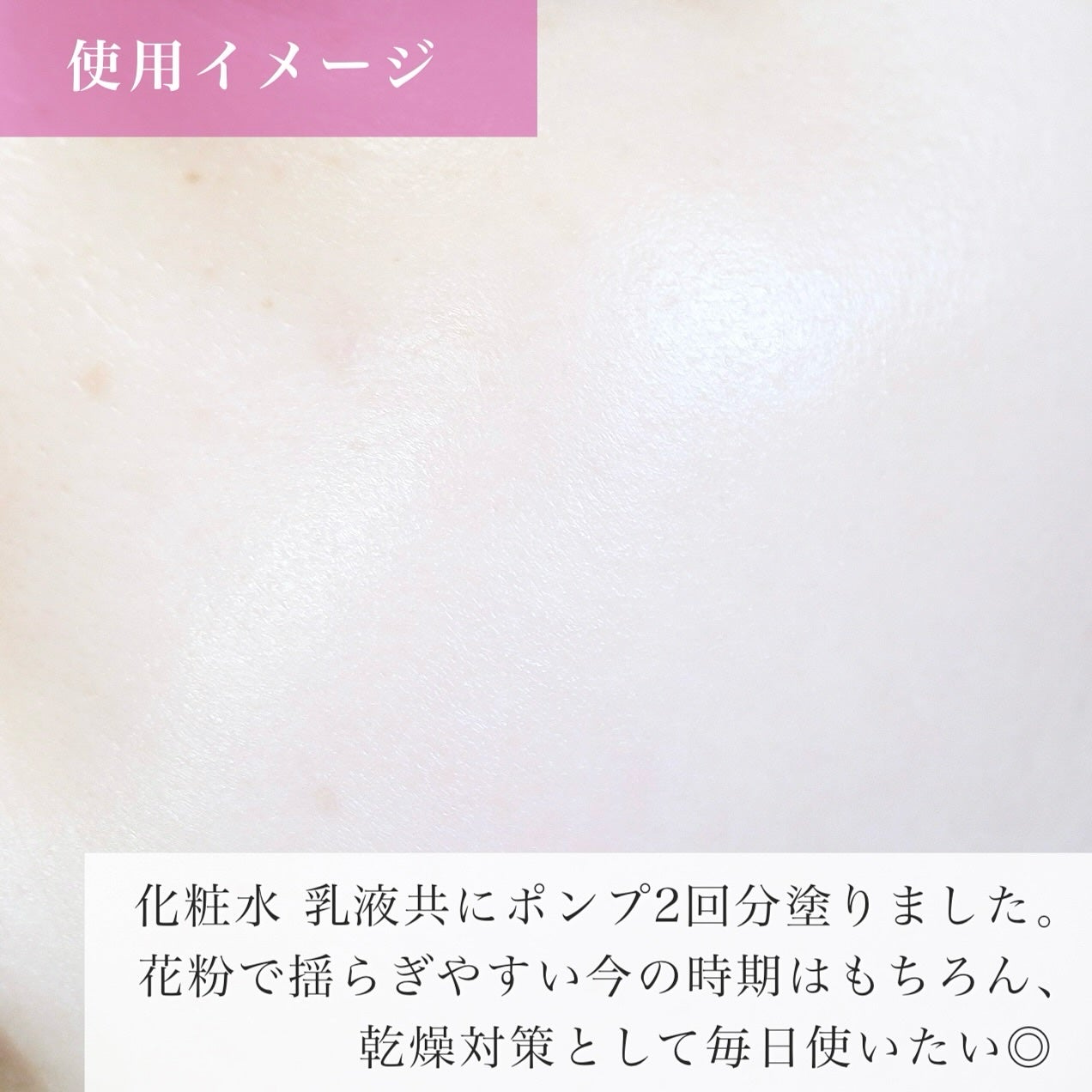 モイスチュア ローション/カルテHD/化粧水を使ったクチコミ(6枚目)