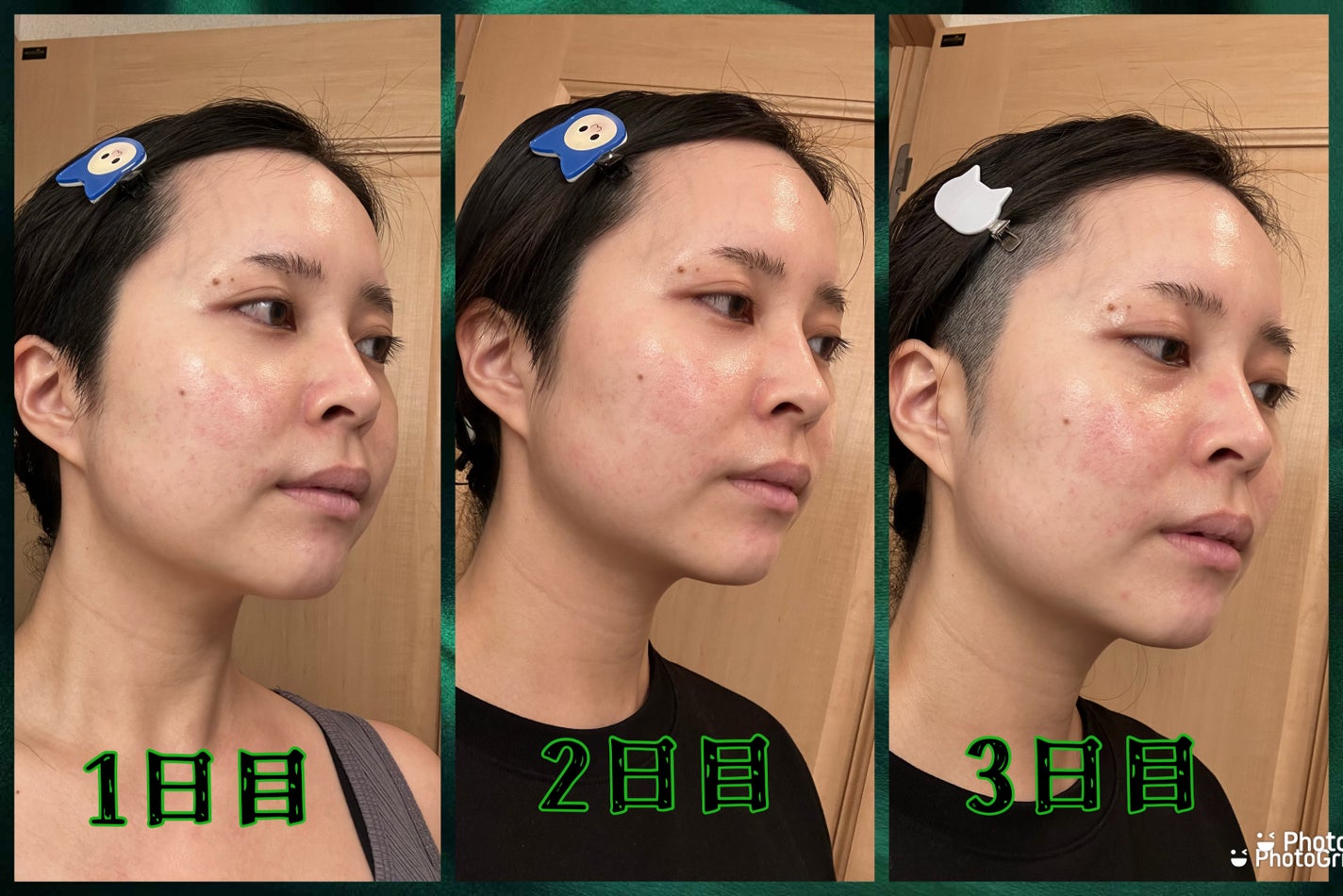 ðððŒð°ðàŸàœ²ð on LIPS ãâ¡.·â¯â¯â¯â¯â¯â¯â¯â¯â¯â¯â¯â¯â¡.·ãã¯ããã°ãã¡ãðàŸàœ²ðå..ãïŒ4æç®ïŒ