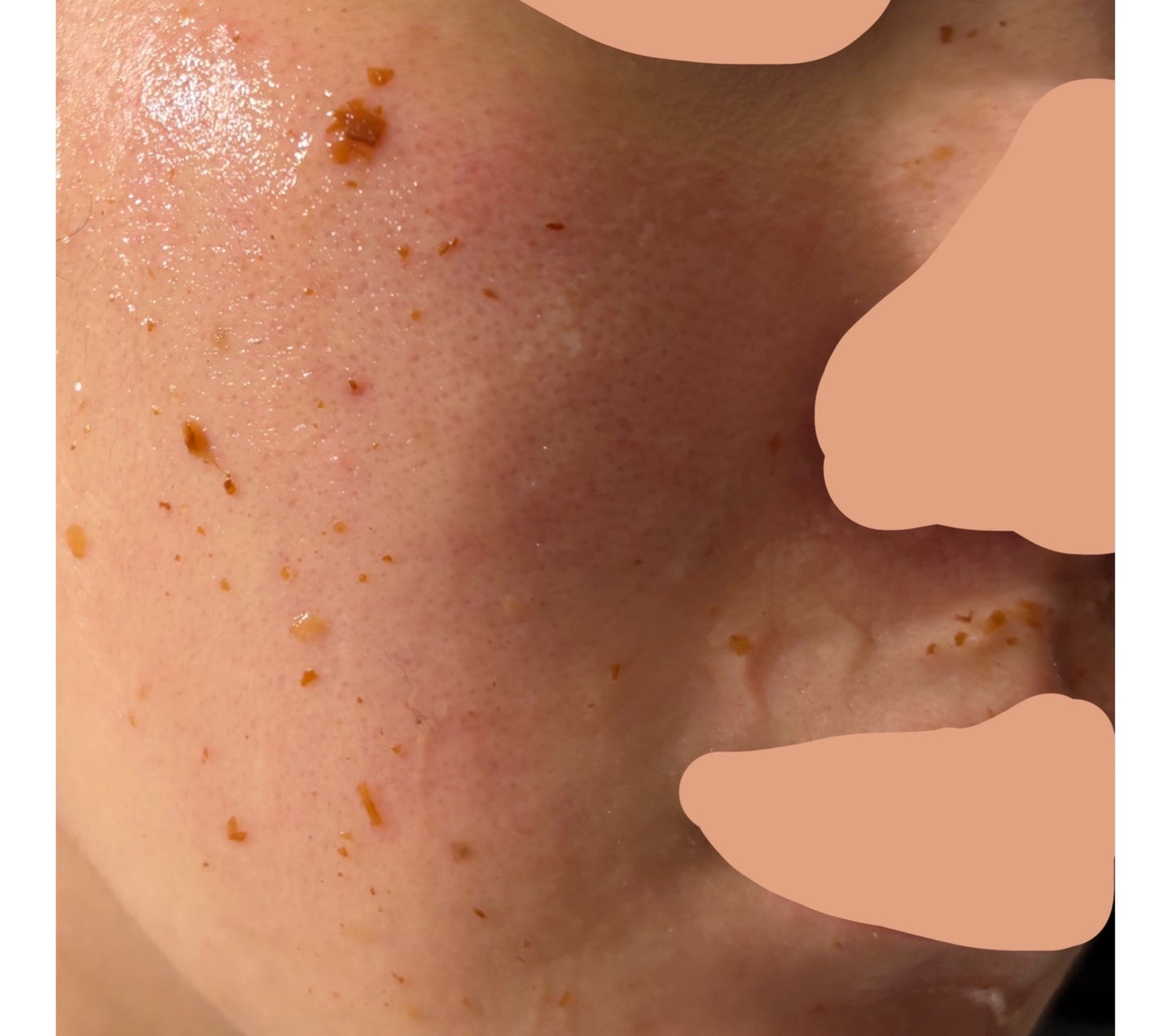 フラワーインフューズド ファインマスク/FEMMUE/洗い流すパック・マスクを使ったクチコミ(2枚目)