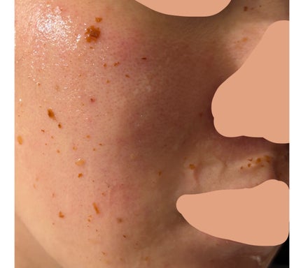 フラワーインフューズド ファインマスク/FEMMUE/洗い流すパック・マスクを使ったクチコミ(2枚目)