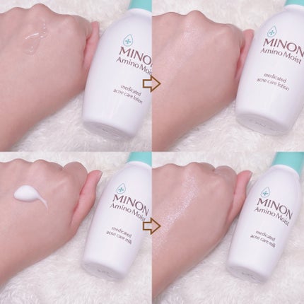 ããã³ ã¢ããã¢ã€ã¹ã è¬çšã¢ã¯ãã±ã¢ ããŒã·ã§ã³/ããã³/åç²§æ°Žã䜿ã£ãã¯ãã³ãïŒ2æç®ïŒ