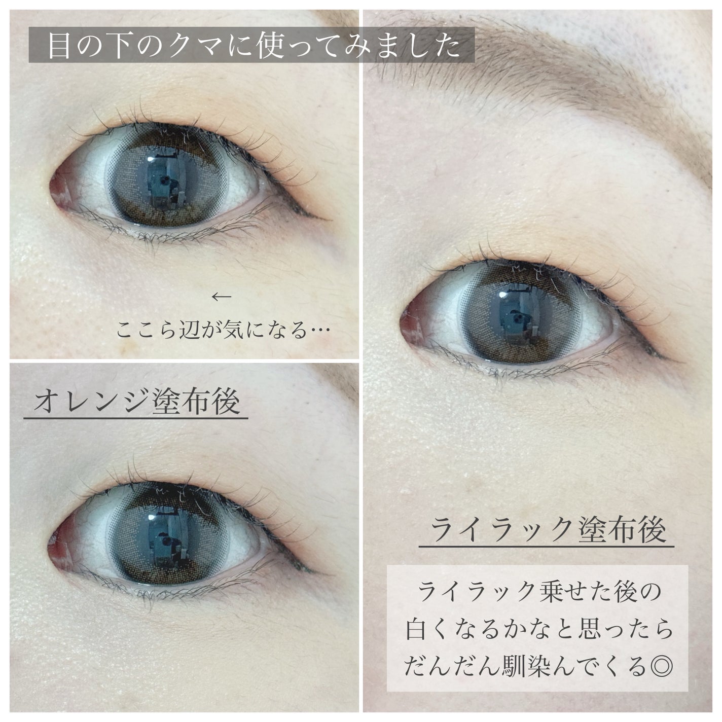 アルビオン スタジオ レイヤードトリック コンシーラー/ALBION/パレットコンシーラーを使ったクチコミ(7枚目)