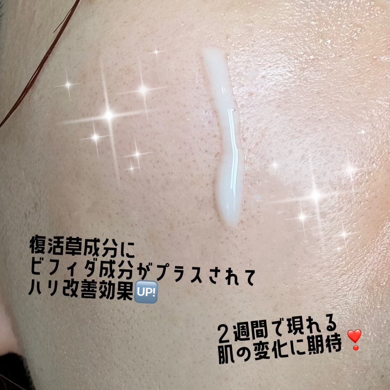 復活草ビフィダセラムファーミングドロップ/Abib /美容液を使ったクチコミ（3枚目）