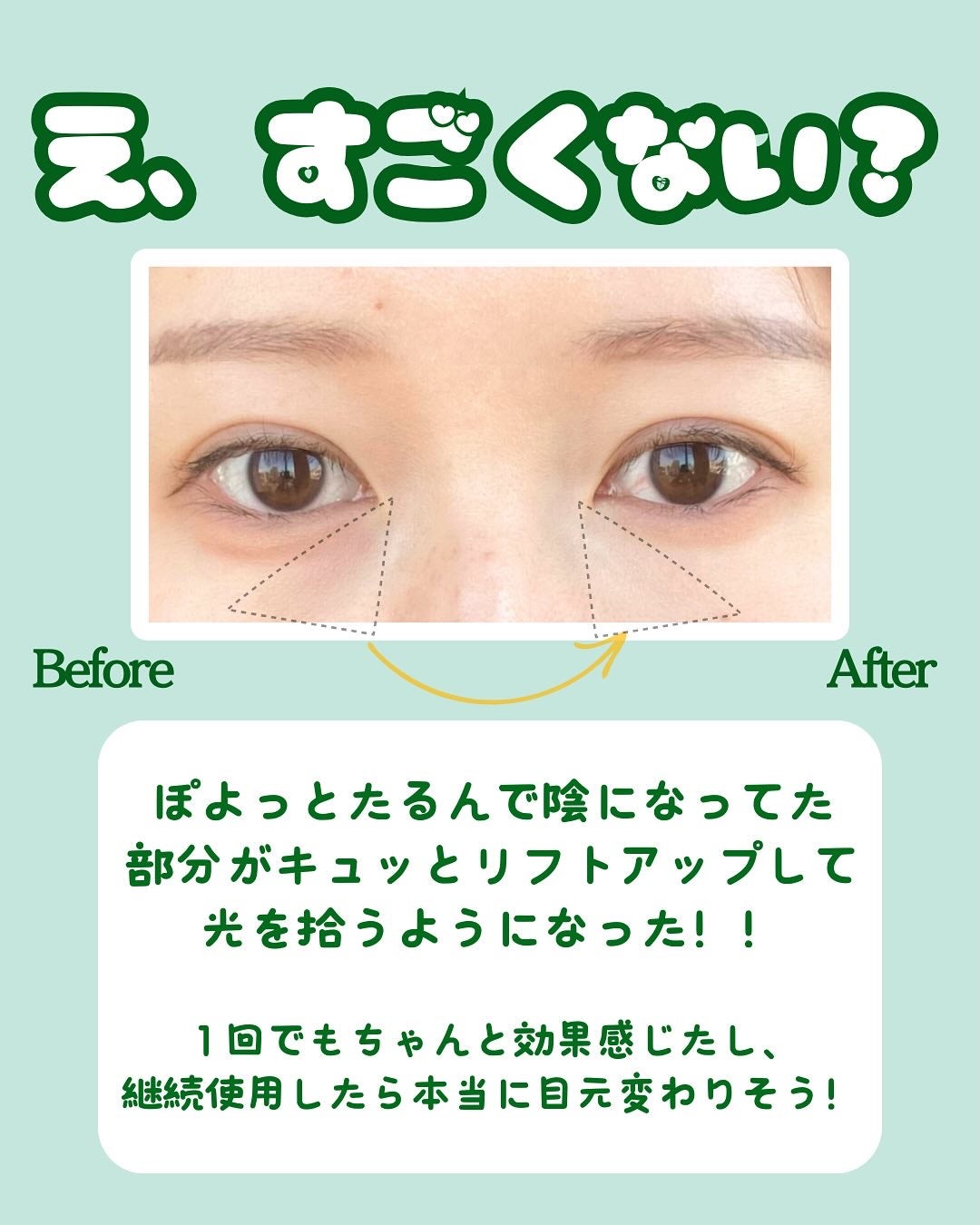 アイファルトアイバッククリーム/Dr.Melaxin/アイケア・アイクリームを使ったクチコミ(4枚目)