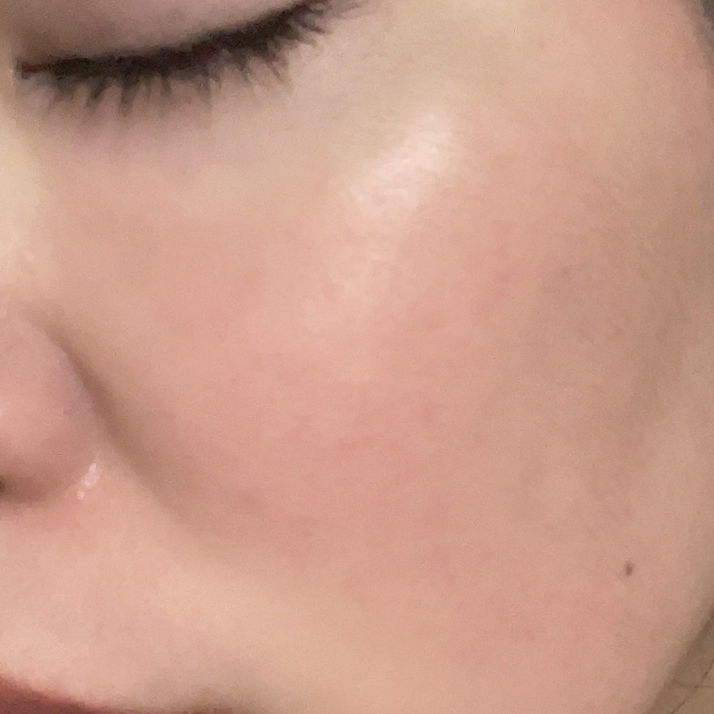 肌美精 CHOI薬用化粧水 ニキビケア[医薬部外品]/肌美精/化粧水を使ったクチコミ（3枚目）