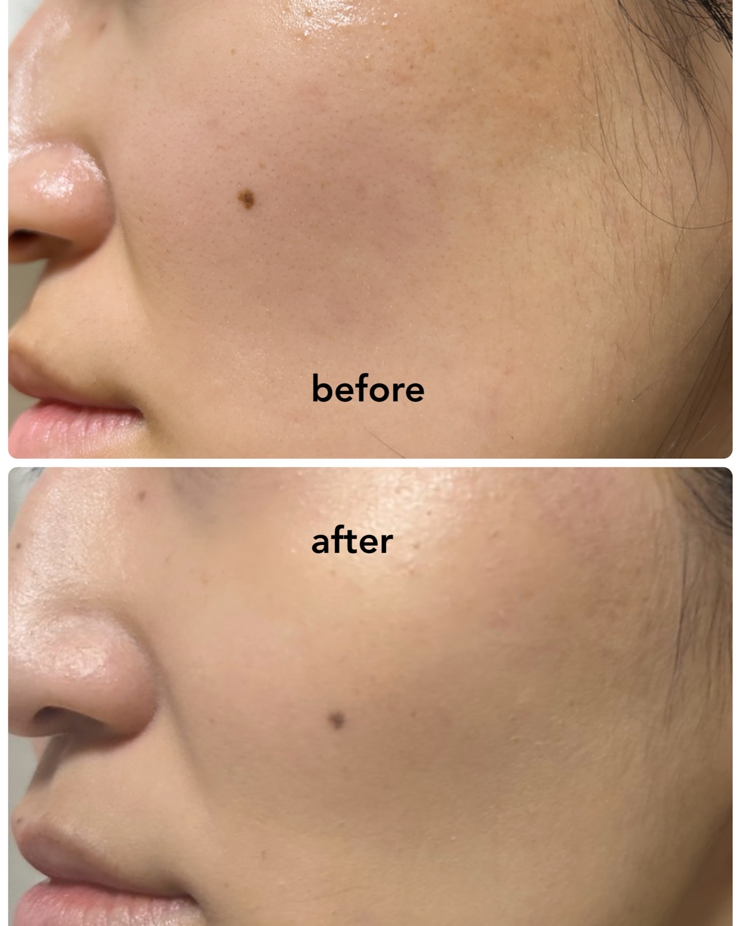 モイストラボ　ハイカバー薬用美白BBクリーム/Moist Labo/BBクリームを使ったクチコミ（3枚目）