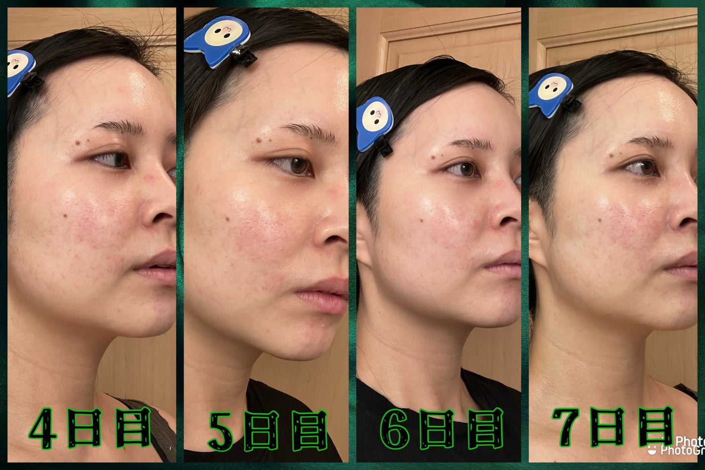 ðððŒð°ðàŸàœ²ð on LIPS ãâ¡.·â¯â¯â¯â¯â¯â¯â¯â¯â¯â¯â¯â¯â¡.·ãã¯ããã°ãã¡ãðàŸàœ²ðå..ãïŒ5æç®ïŒ