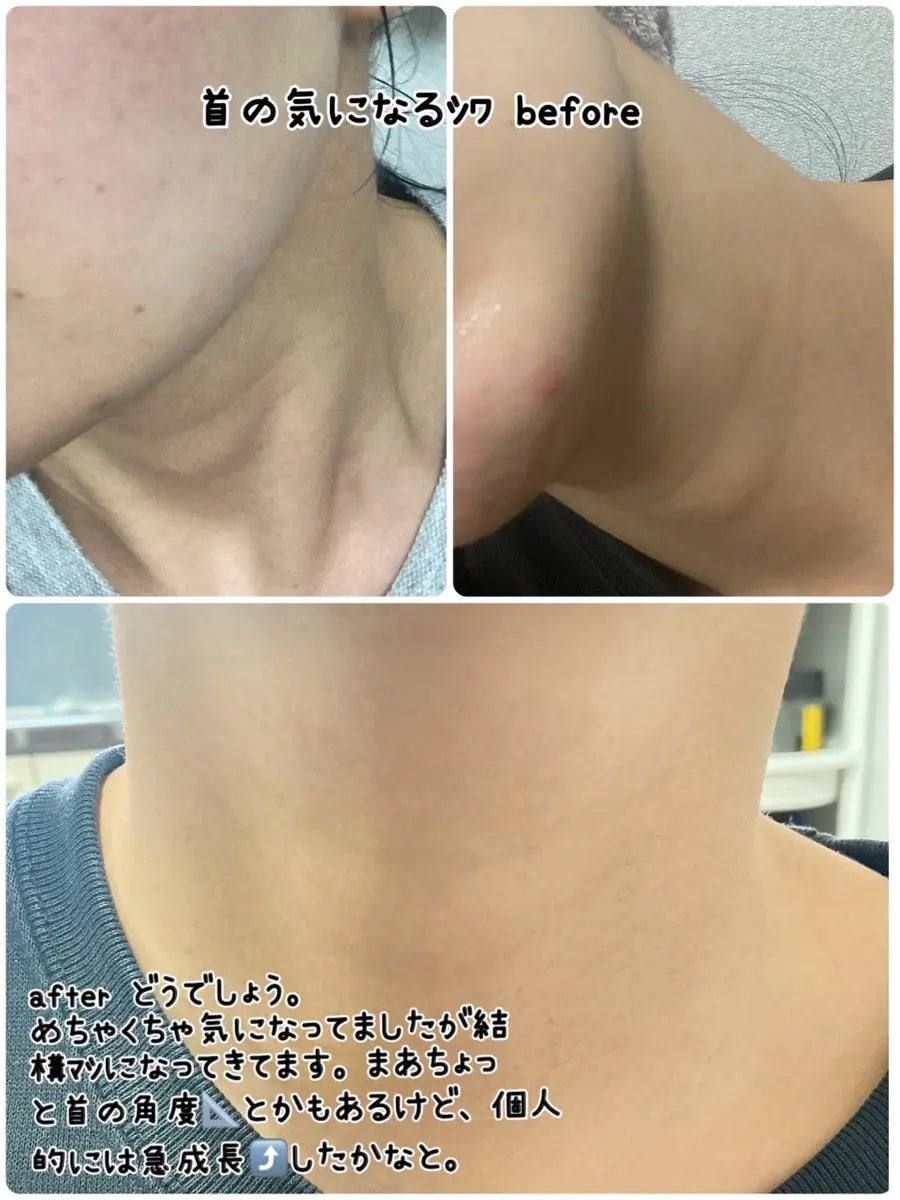 ディセラクリーム+ローラーset/リリーイブ/レッグ・フットケアを使ったクチコミ(4枚目)