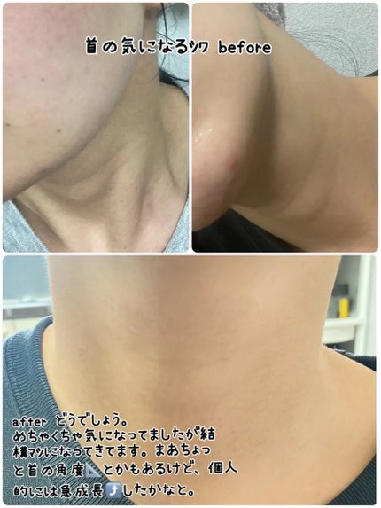 ディセラクリーム+ローラーset/リリーイブ/レッグ・フットケアを使ったクチコミ(4枚目)