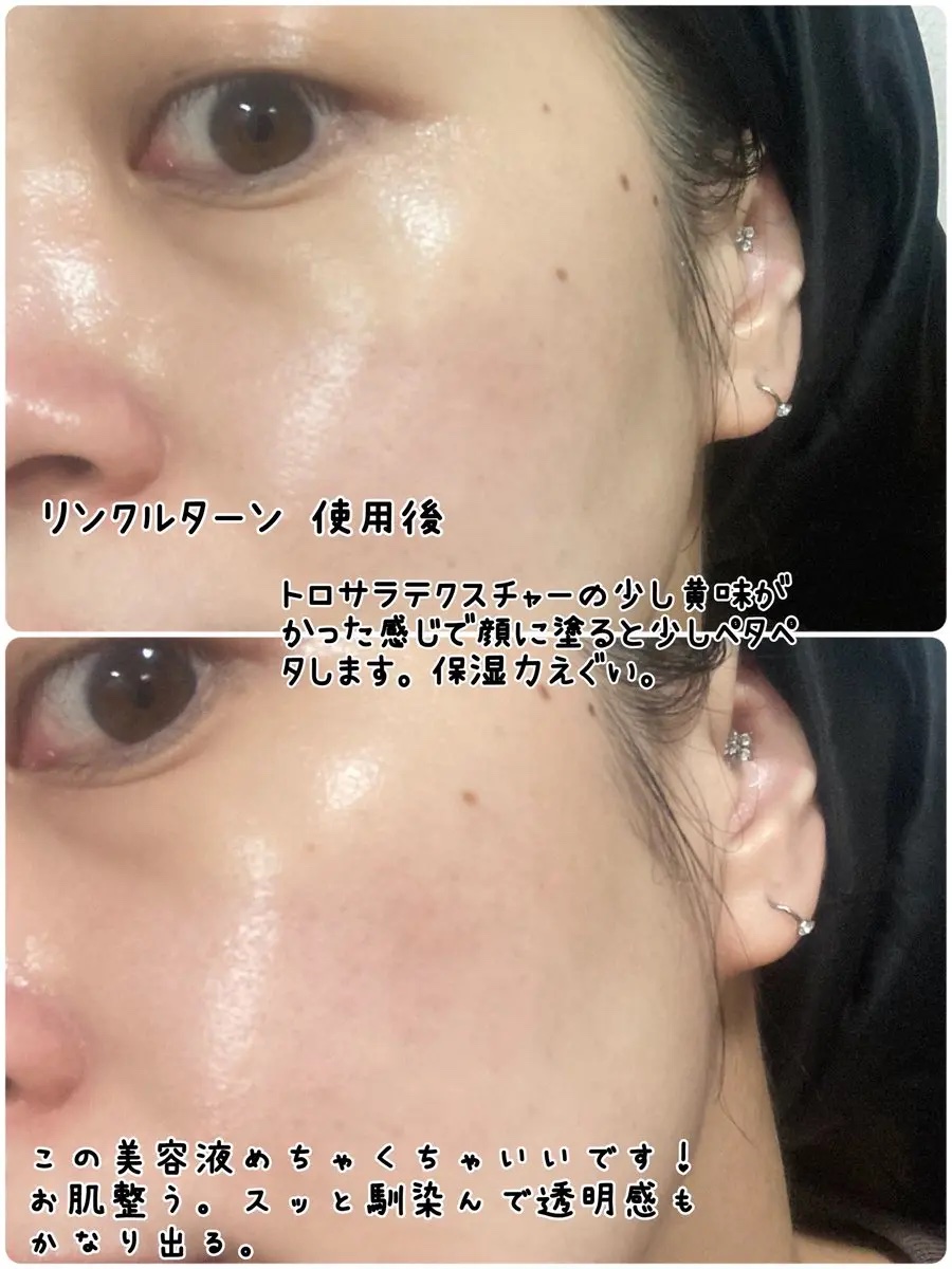 サナ　リンクルターン　アドバンスト　薬用リペア　ダイブインチャージ【医薬部外品】/サナ　リンクルターン/美容液を使ったクチコミ（3枚目）