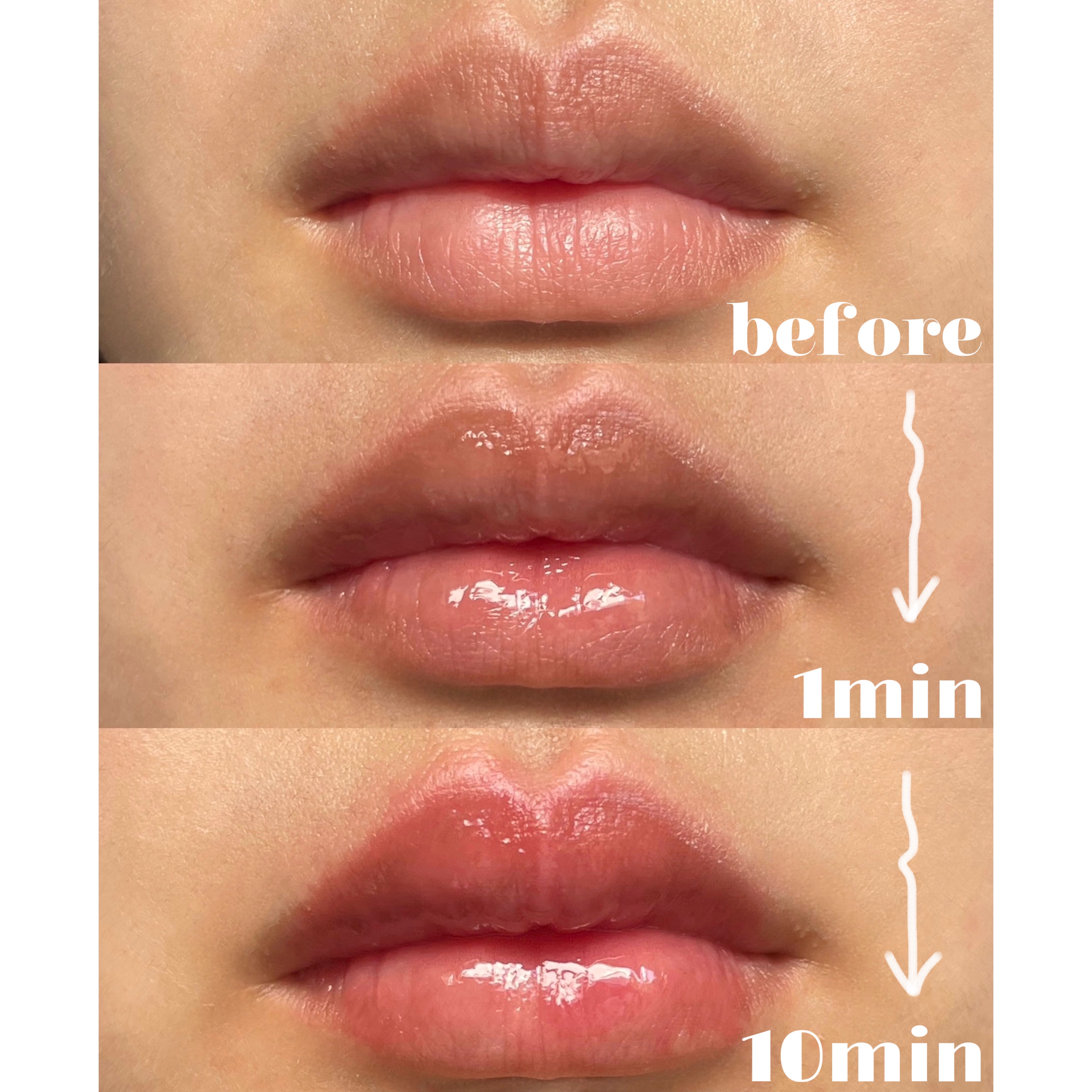 ボリュームリッププランパー/BANILA CO/リッププランパーを使ったクチコミ（2枚目）