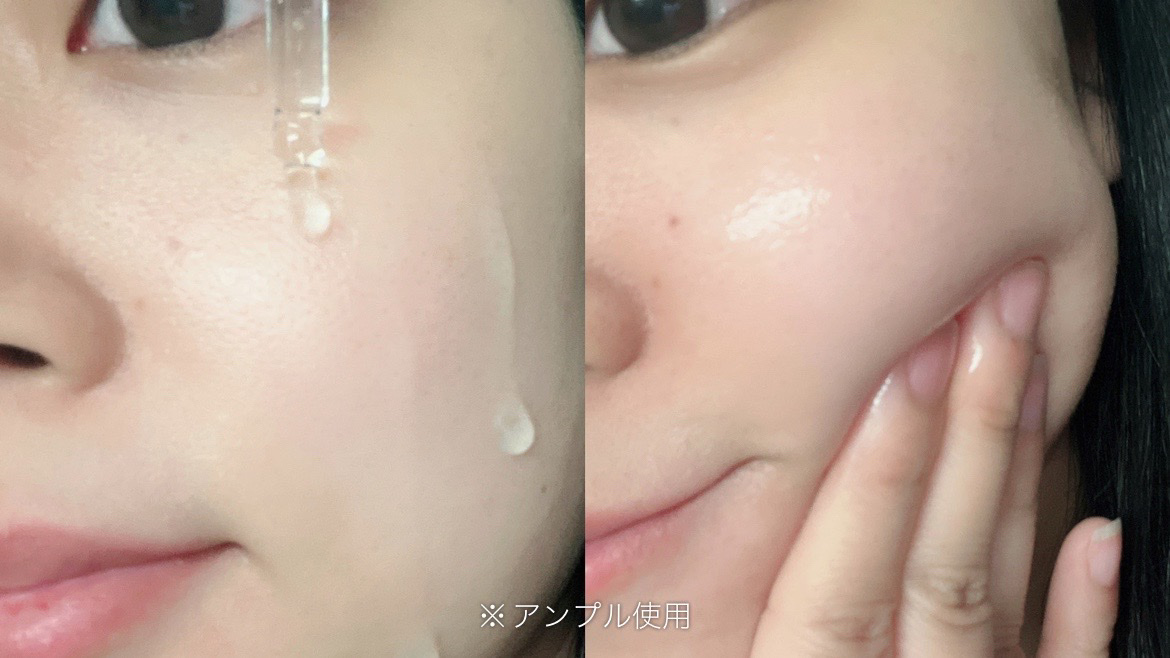 Young Cica PDRN TROUBLE SOOTHING ESSENCE AMPOULE/MEDIPEEL/美容液を使ったクチコミ（3枚目）