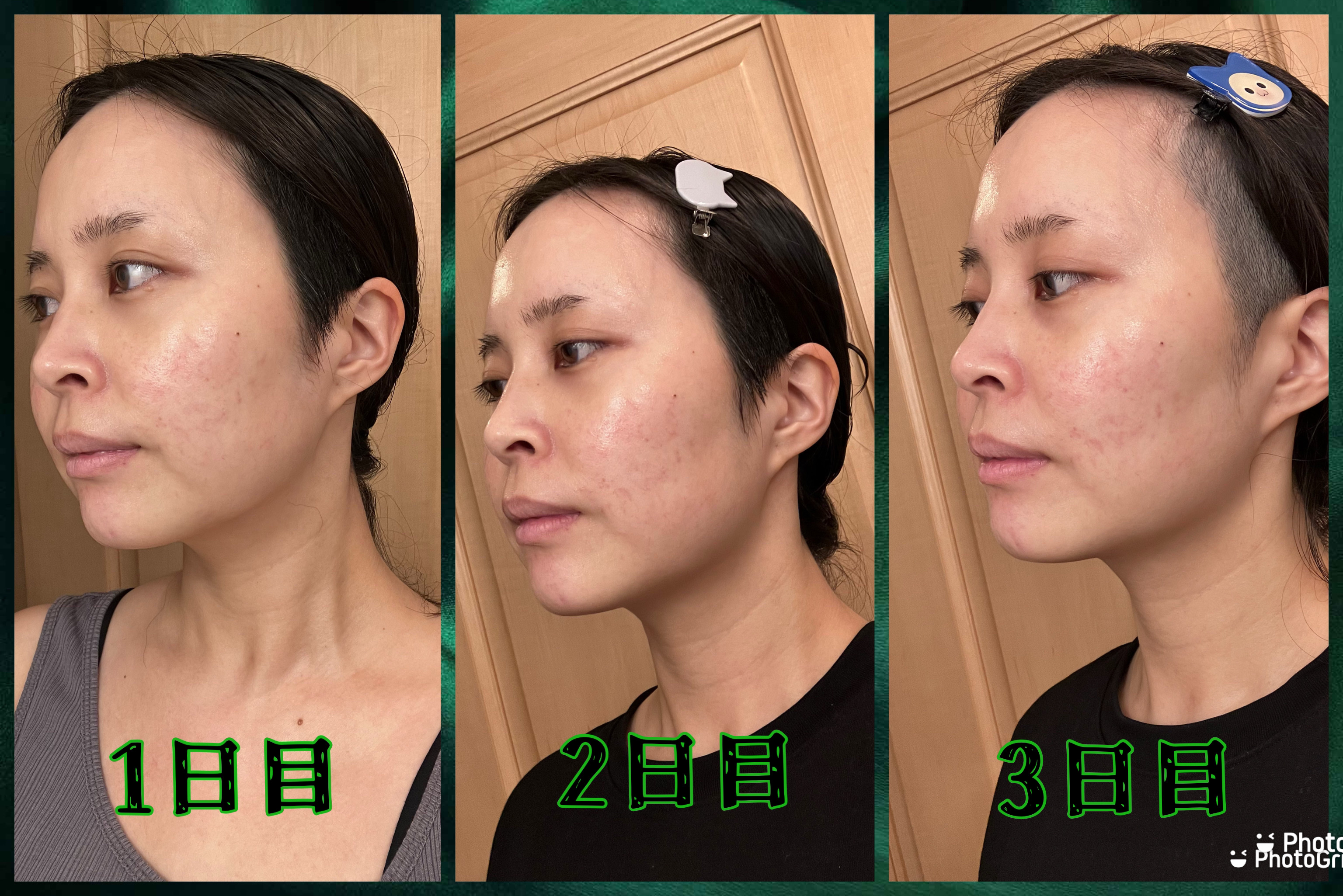 を使ったクチコミ（2枚目）