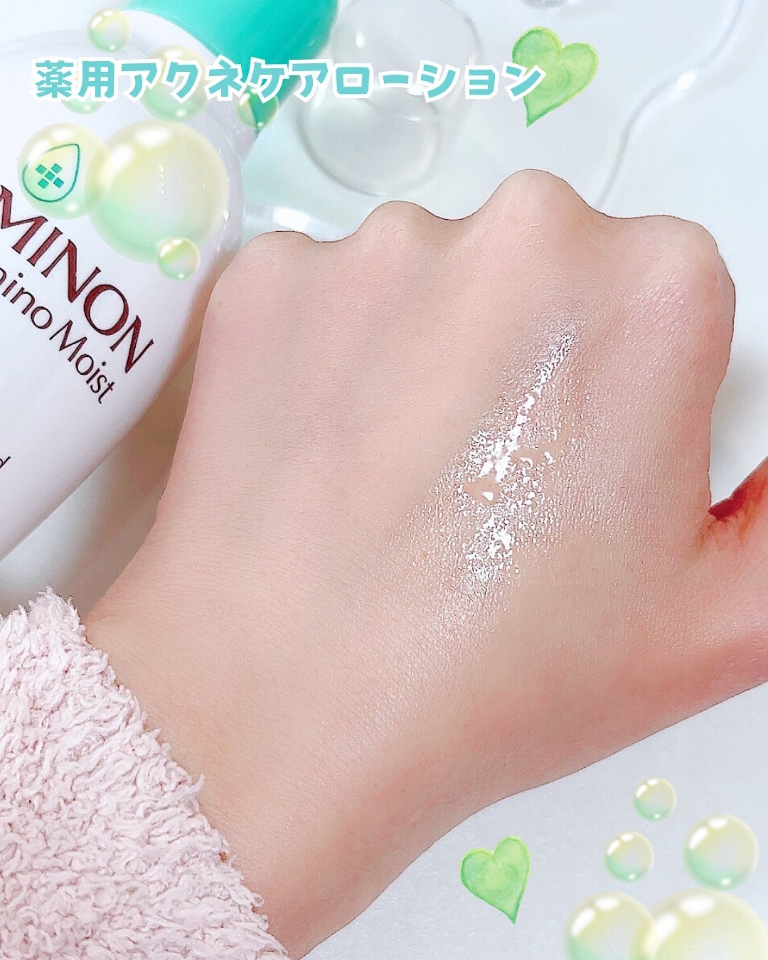 ミノン アミノモイスト 薬用アクネケア ローション/ミノン/化粧水を使ったクチコミ(2枚目)