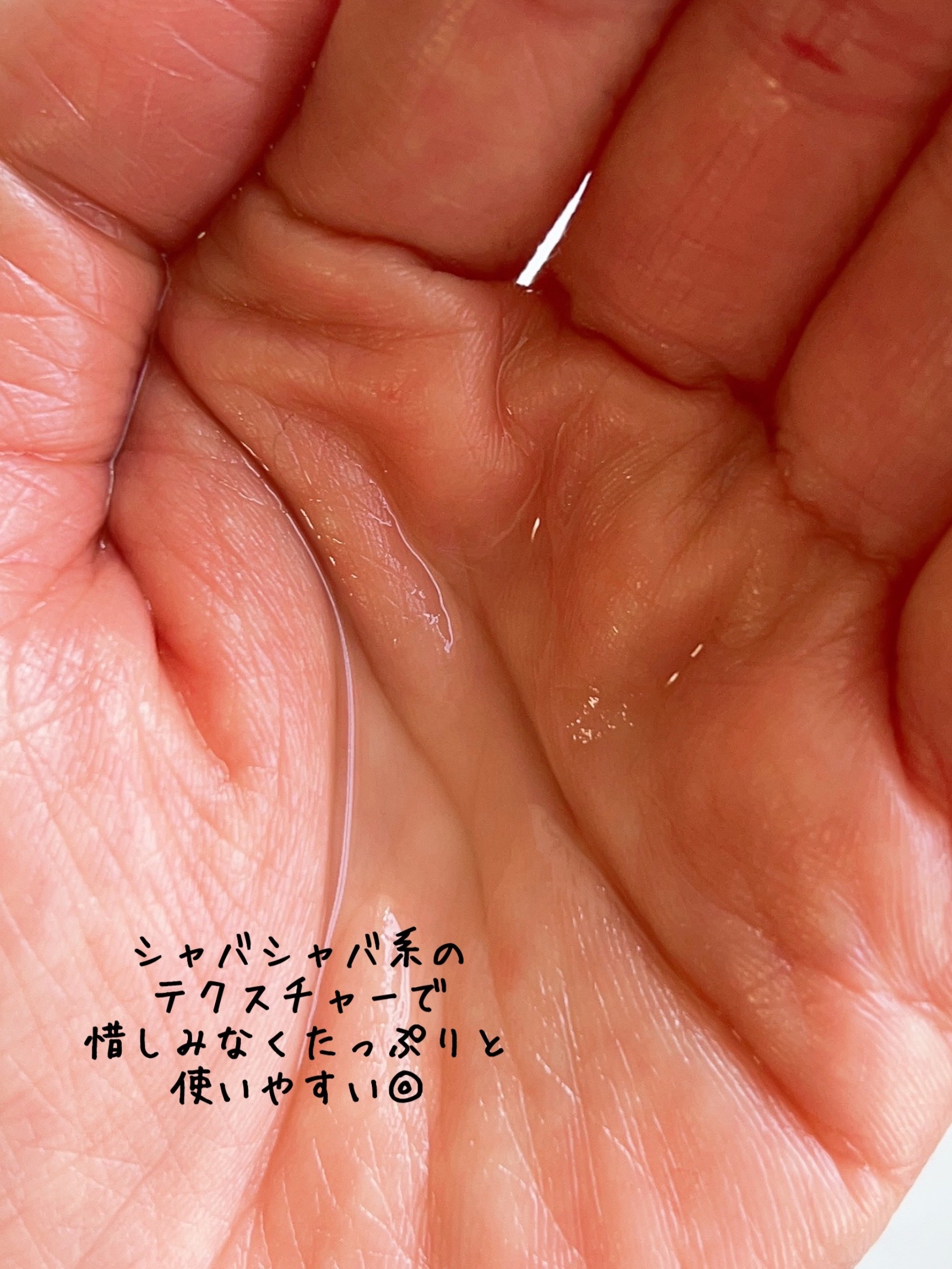 肌美精 CHOI薬用化粧水 ニキビケア[医薬部外品]/肌美精/化粧水を使ったクチコミ（2枚目）