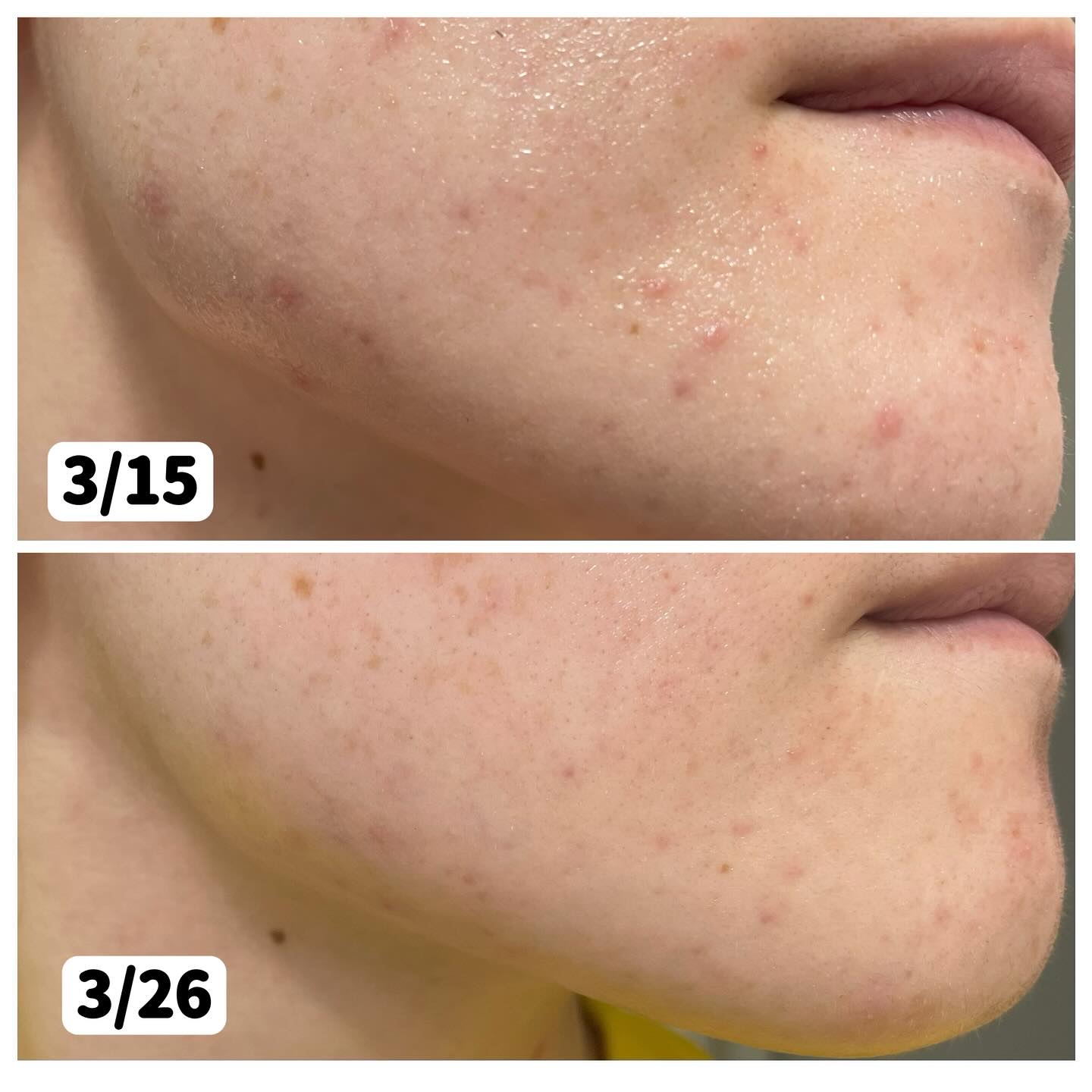 ノスカナイン トラブル セラム/FATION/美容液を使ったクチコミ（3枚目）