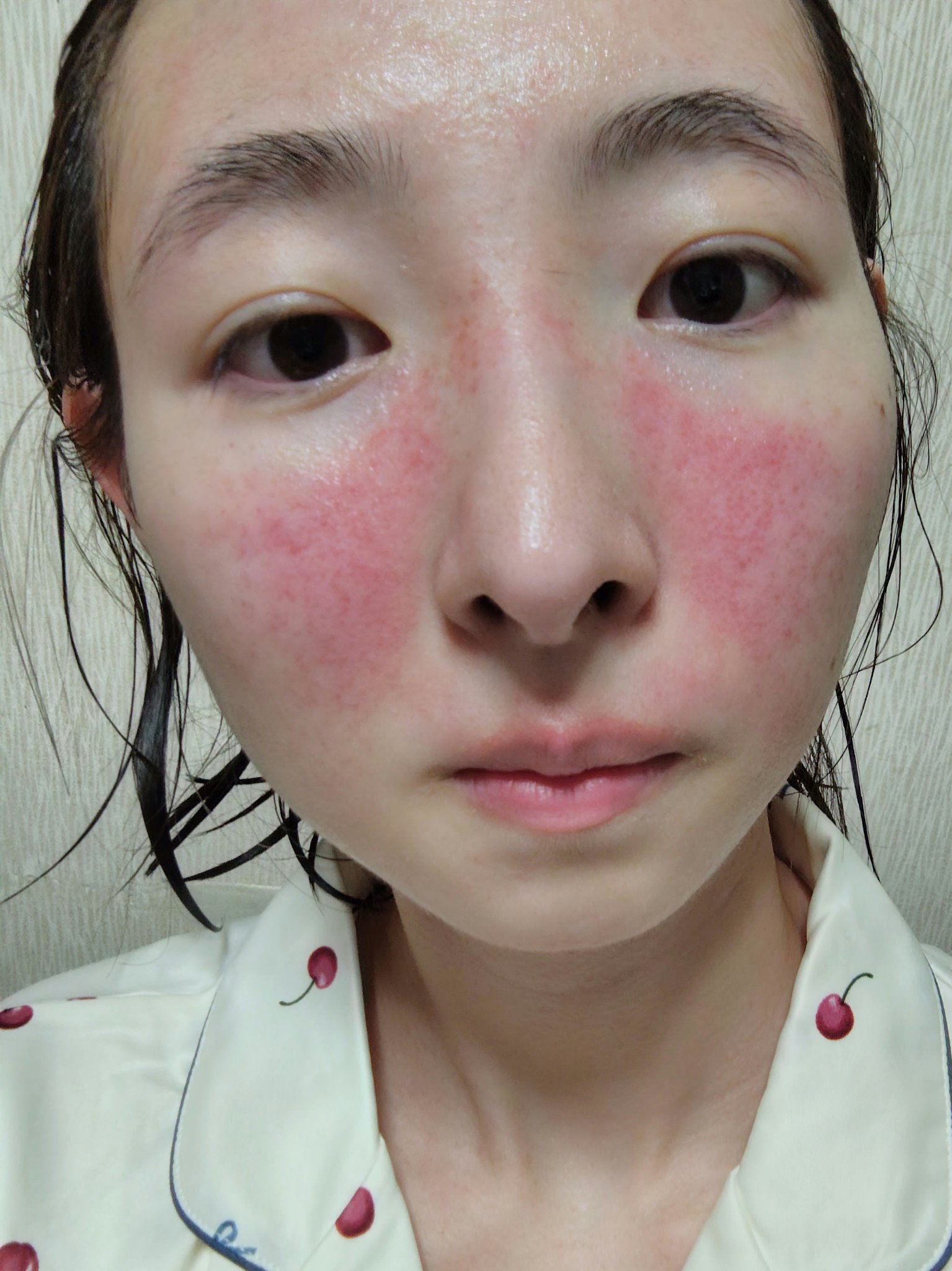 うるおいローション/シンプルバランス/オールインワン化粧品を使ったクチコミ（3枚目）