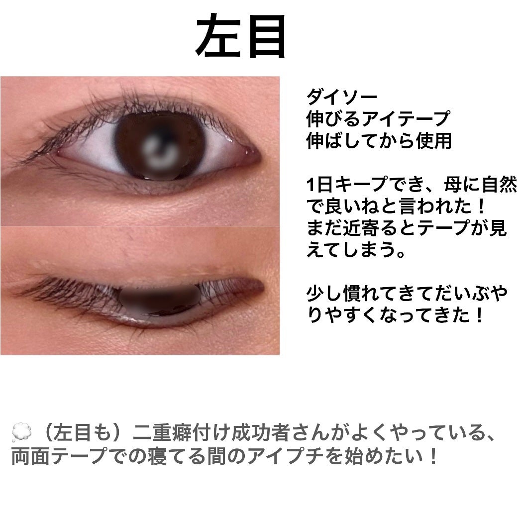 Karin on LIPS 「Karinの二重日記📓♡D-2二重テープの貼り方を参考にさせて..」(3枚目)