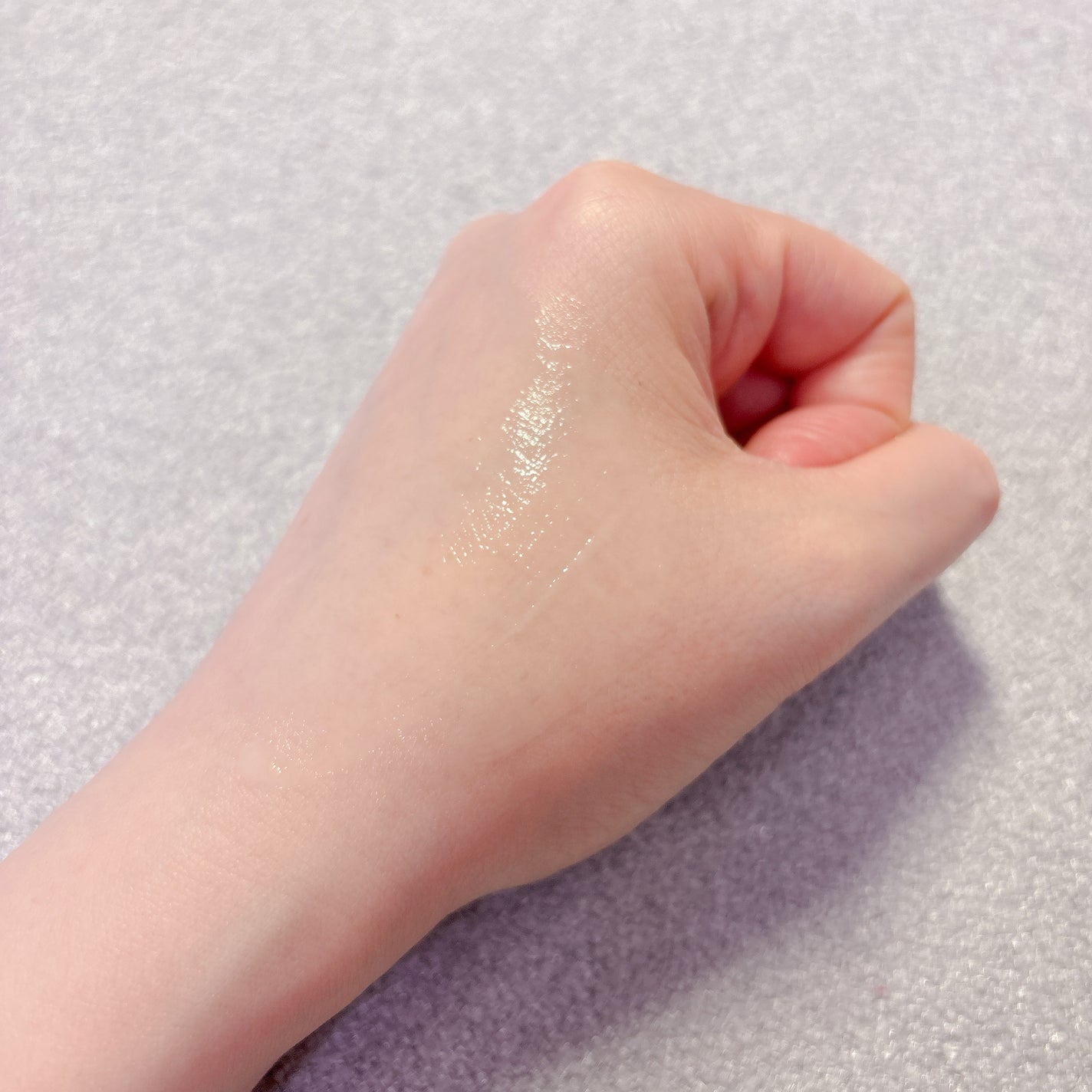 ミノン アミノモイスト 薬用アクネケア ローション/ミノン/化粧水を使ったクチコミ(5枚目)