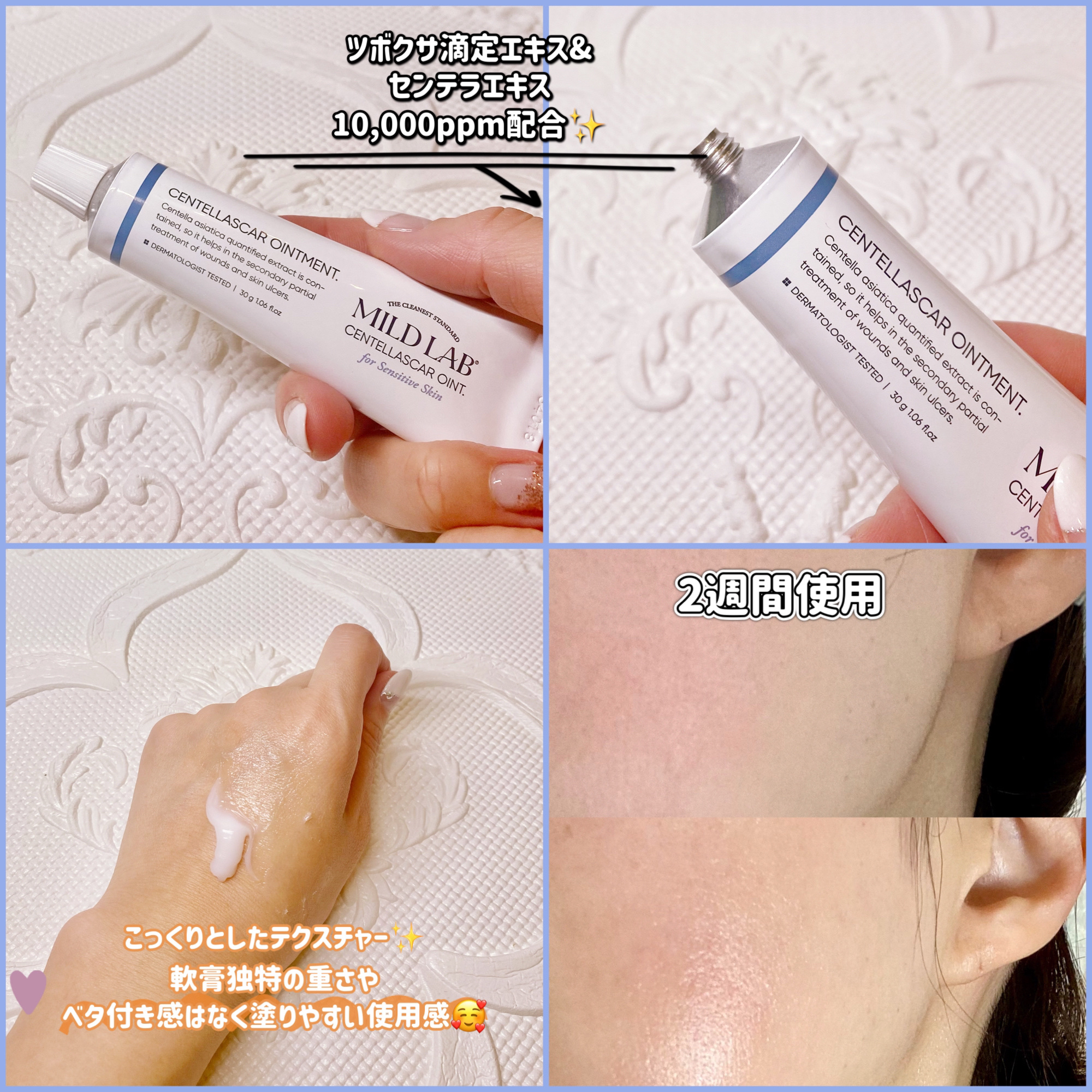 センテラスカー 軟膏 (オイントメント)/Mildlab/フェイスクリームを使ったクチコミ（2枚目）
