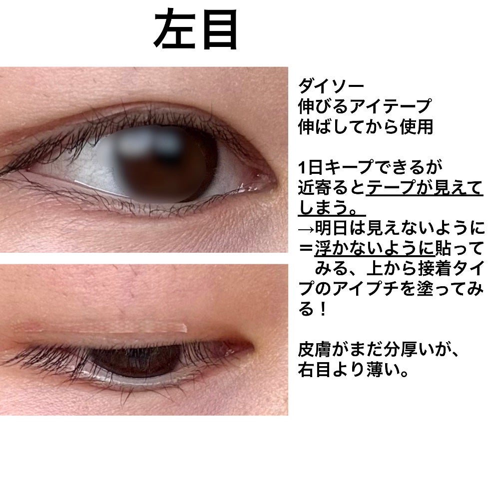 のびーるアイテープ(絆創膏タイプ、レギュラー)/DAISO/二重まぶた用アイテムを使ったクチコミ(3枚目)