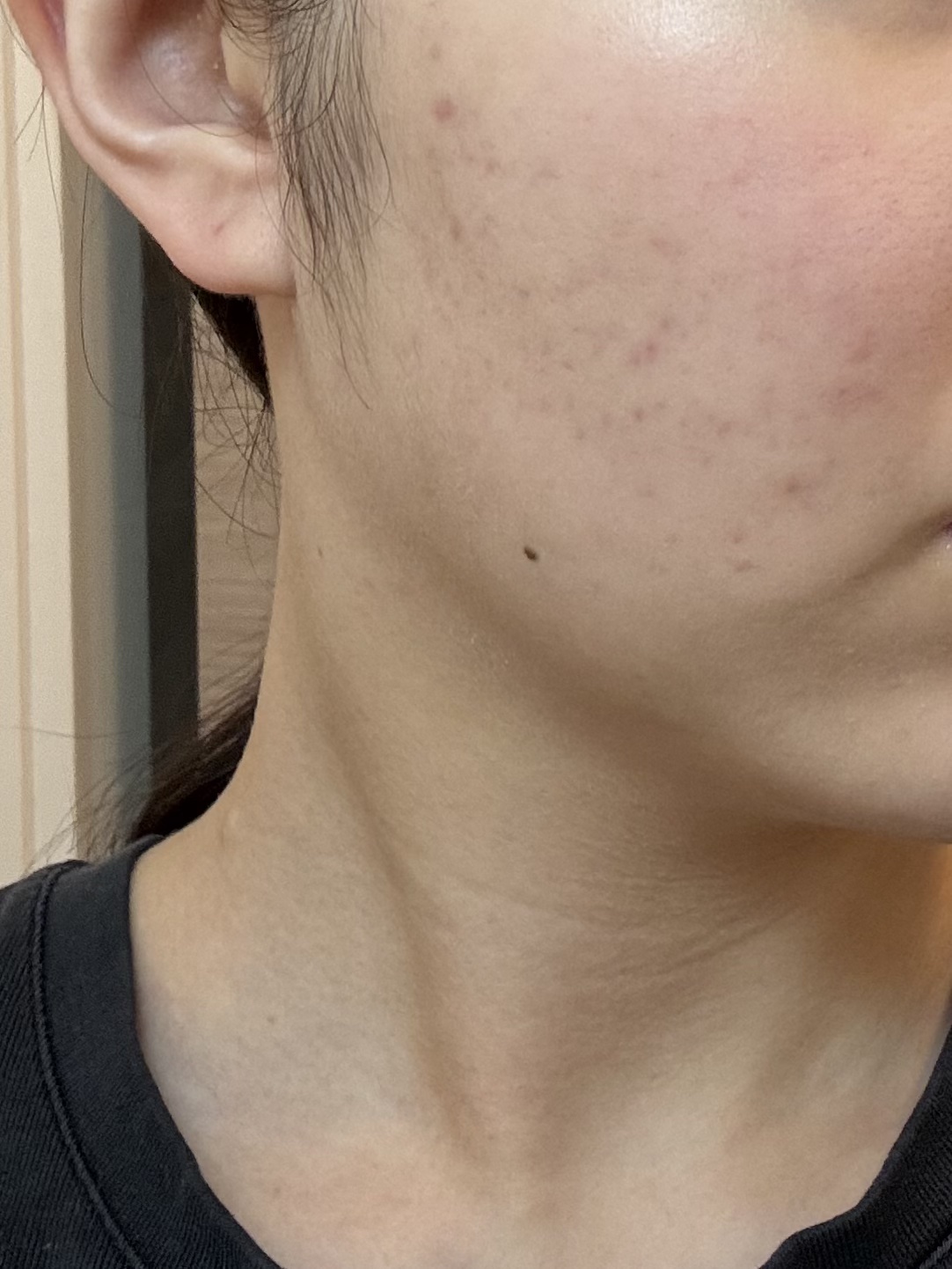 肌をうるおす保湿浸透水 モイストリッチ/松山油脂/化粧水を使ったクチコミ（1枚目）