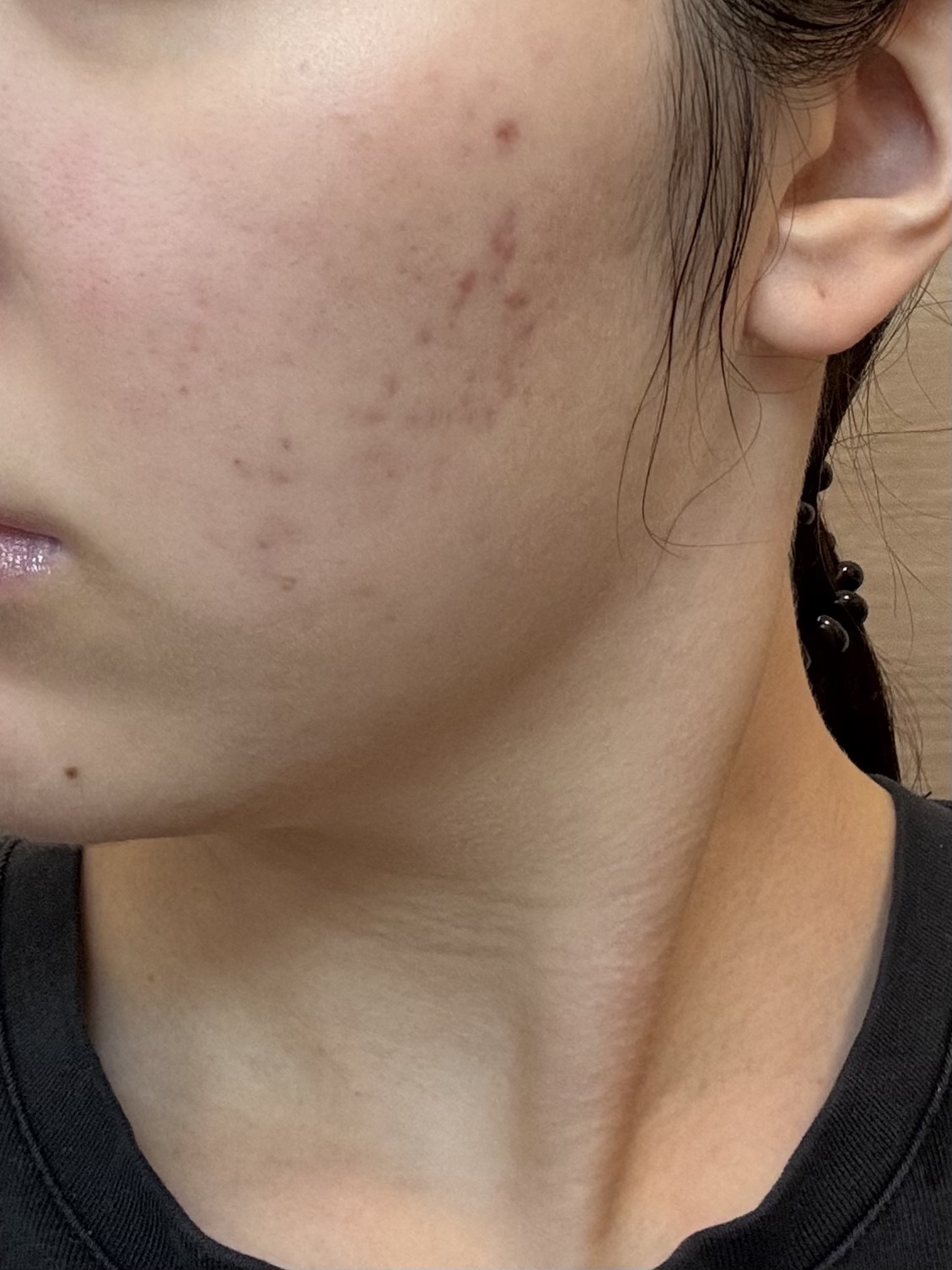 肌をうるおす保湿浸透水 モイストリッチ/松山油脂/化粧水を使ったクチコミ（2枚目）