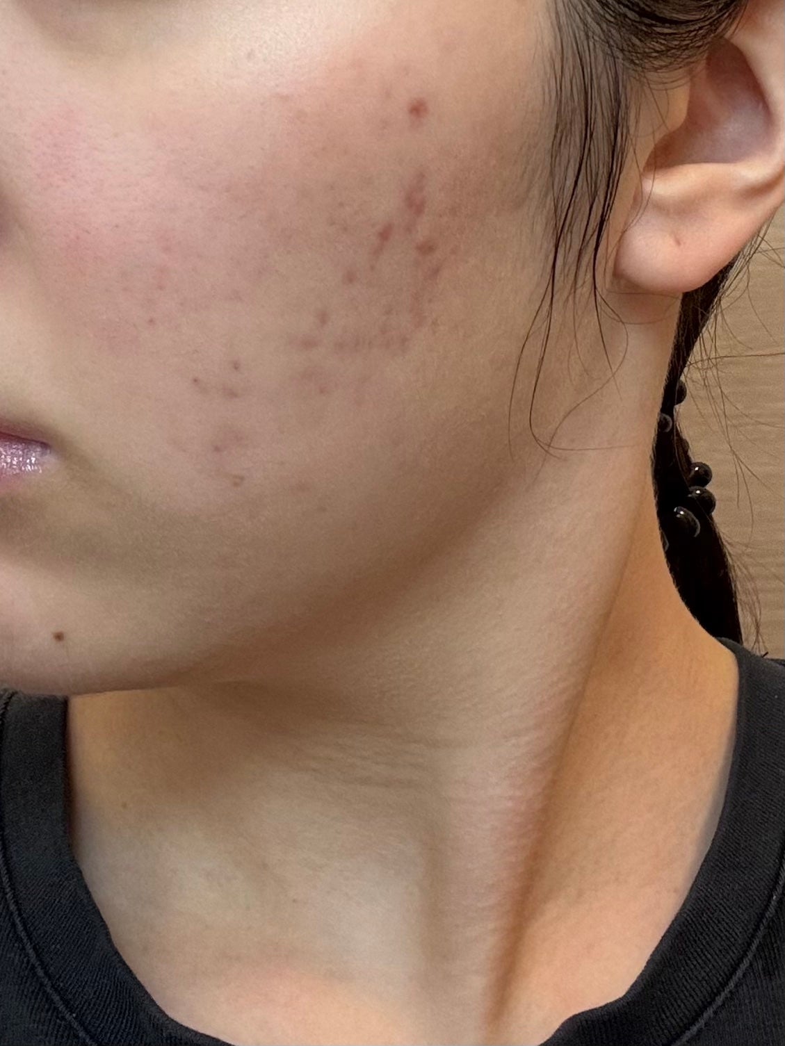 浸透湿潤セラミド10%★ナノエマルジョン/TOUT VERT/乳液を使ったクチコミ(2枚目)